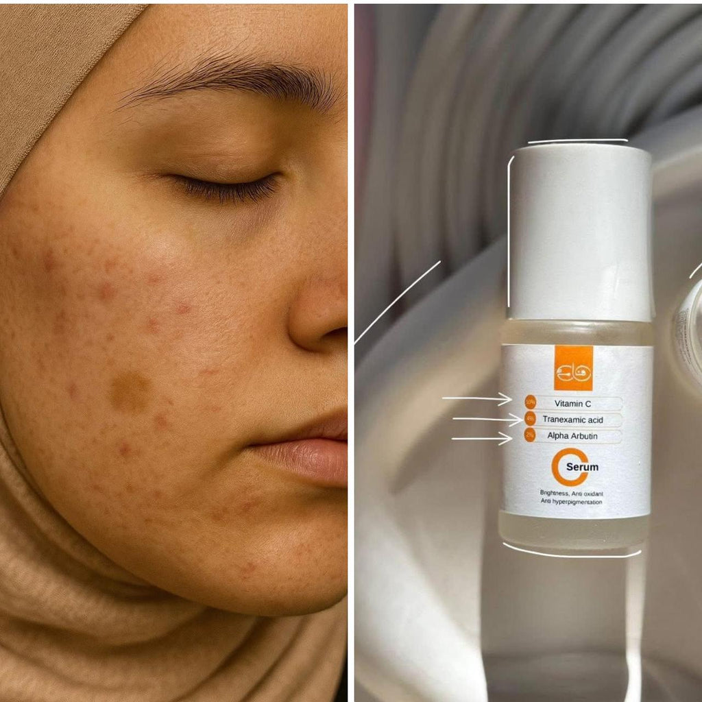 Serum Vit C  4*1