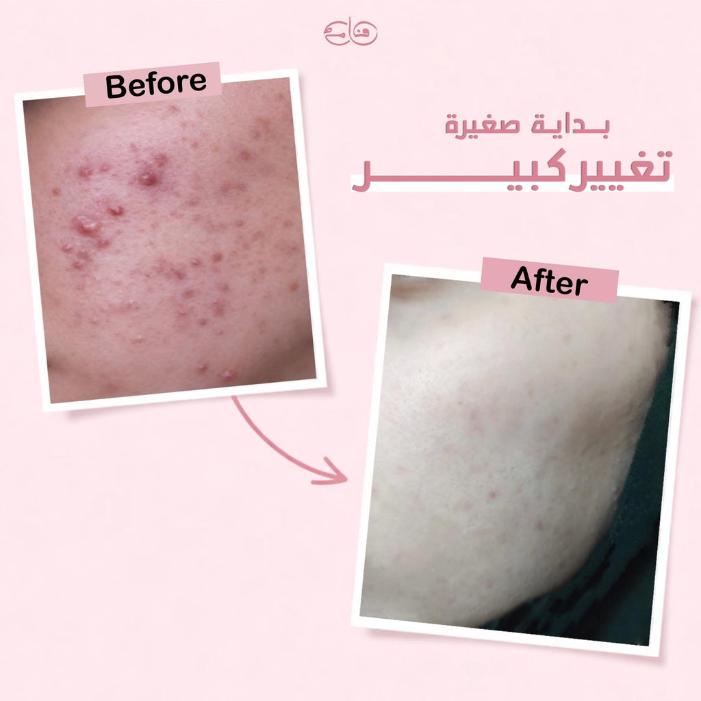 Skincare bundle