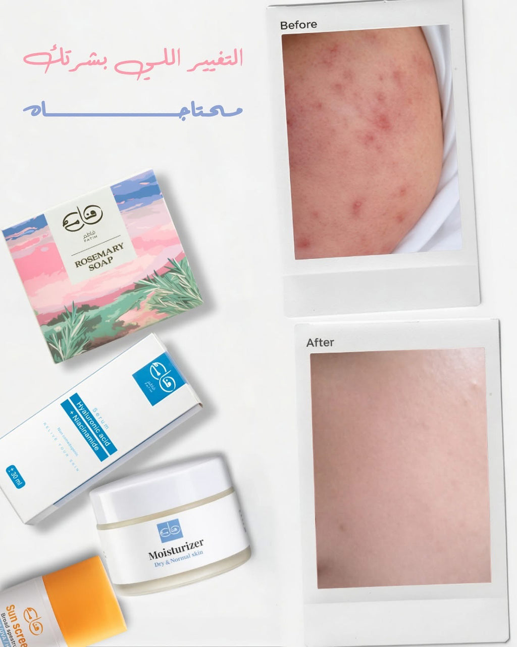 Skincare bundle