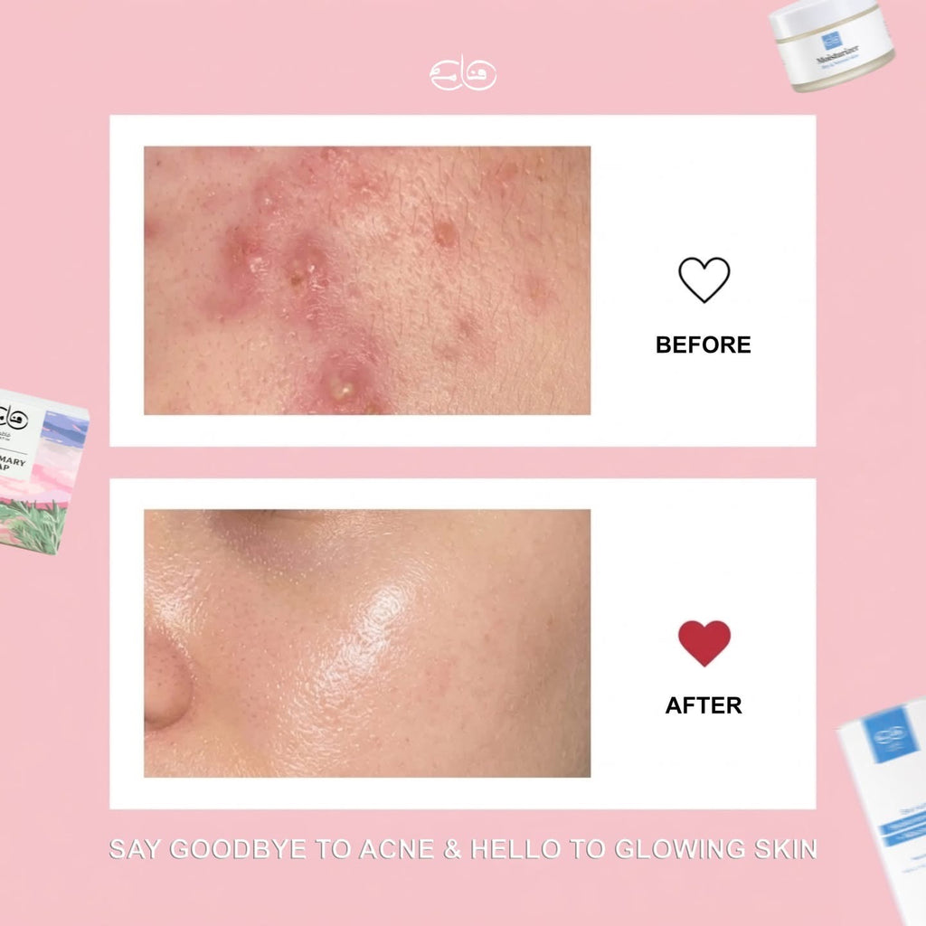 Skincare bundle