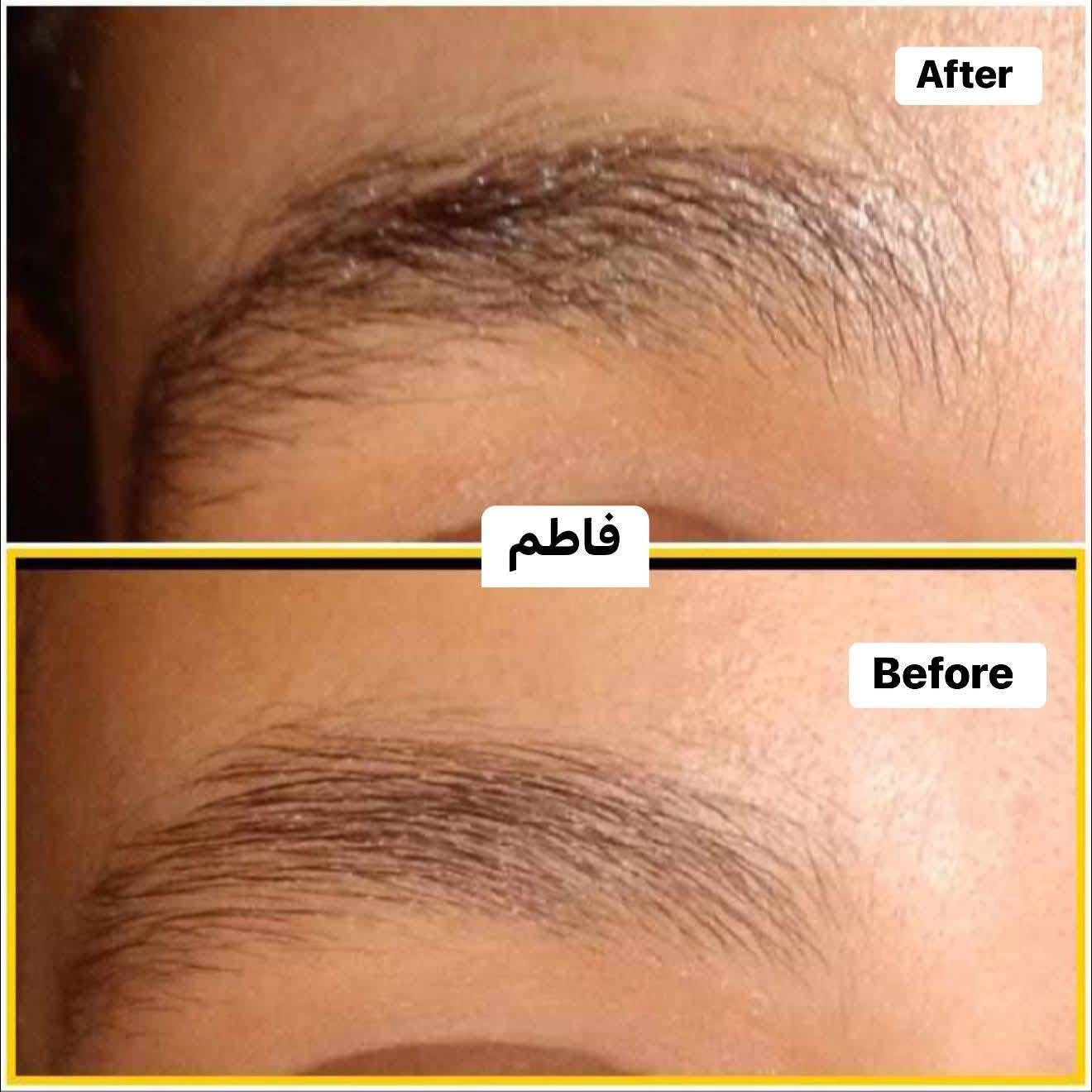 Redensyl Eyelashes & Eyebrows serum Treatment serum